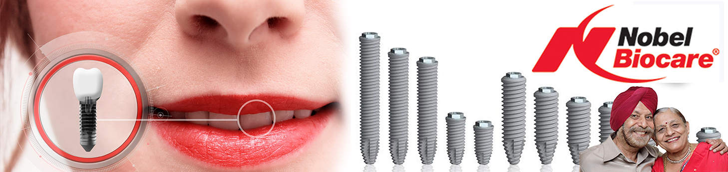Best-Dental-Implants-Centre-New-Delhi-Cutylife-Dental