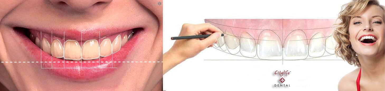 Digital-Smile-Design