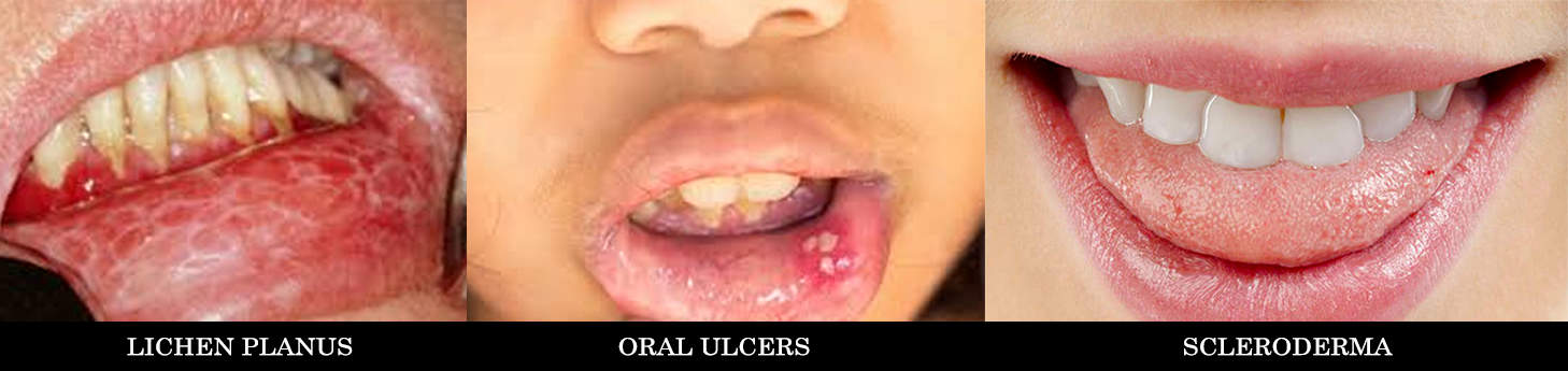 Oral-Medicine-Dentist-Sajili-Mittal